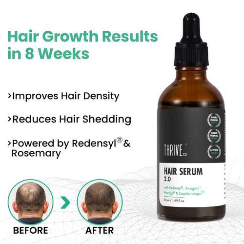 ThriveCo Hair Growth Serum 2.0 For Men & Women | 50ML