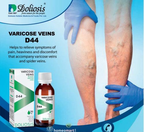 Homeopathic Varicose Veins Treatment | Doliosis D44 Drops