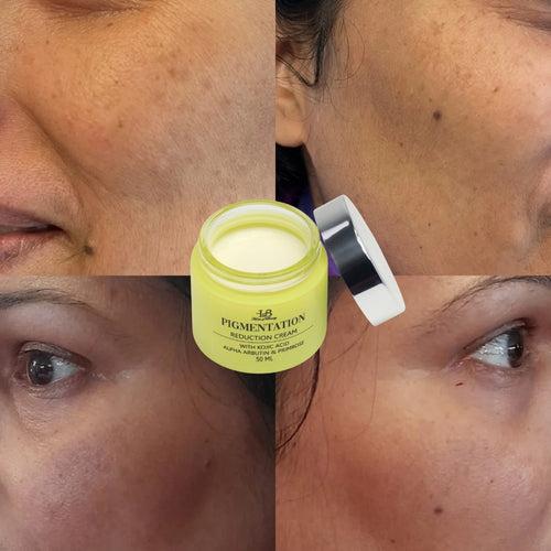 HOB Pigmentation Cream