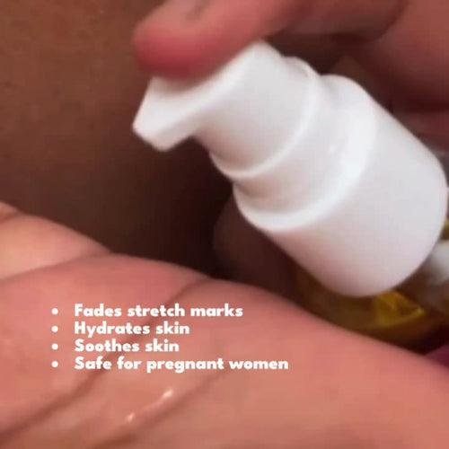 HOB Stretch Mark Oil