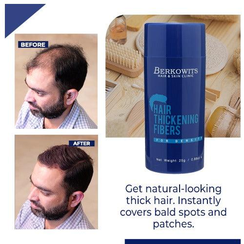 Berkowits Hair Loss Concealer 25 Gm (Pack Of 3) Keratin Hair Fiber with Hair Holding Spray (100ml)