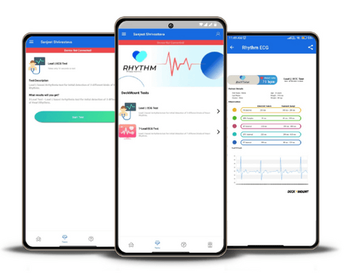 Deck Mount Rhythm Pocket ECG