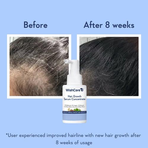 Hair Growth Serum Concentrate With 3% Redensyl, 4% Anagain, Rice Water, Biotin