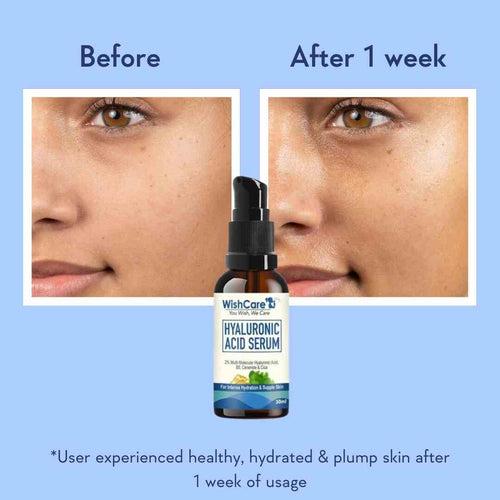 Hyaluronic Acid Serum - 30ml