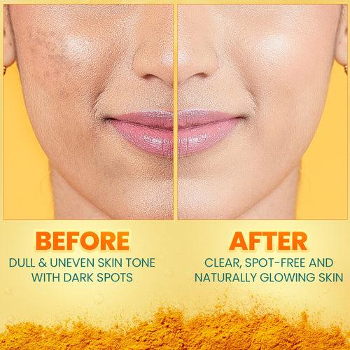 Dark Spot Clearing Turmeric Kit