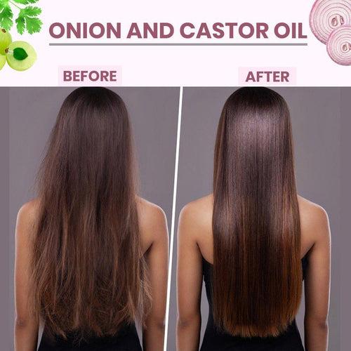 Onion & Castor Hair Oil for Hairfall Control, Hair Regrowth & Dandruff Control 100 ML