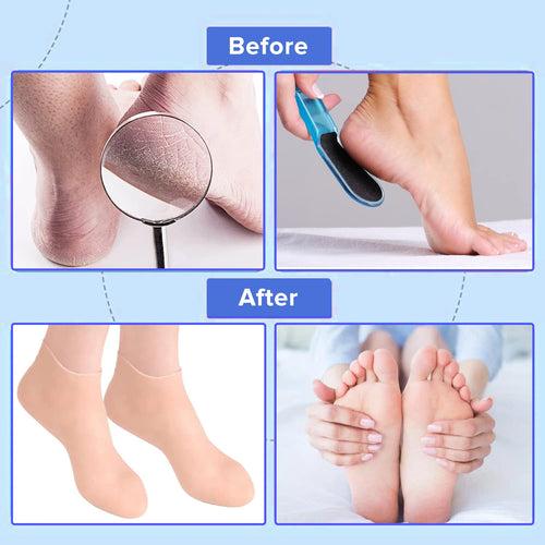 Dr Foot Silicone Socks | Anti Slip Silicone Moisturizing Socks | Dry Cracking Skin | For Both Men & Women | Full Length, Large Size – 1 Pair (Pack of 3)