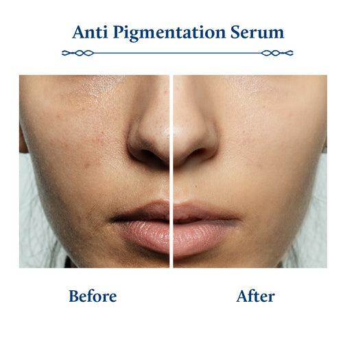 Kojic Acid Face Serum for Pigmentation (13 herbs, 30ml)