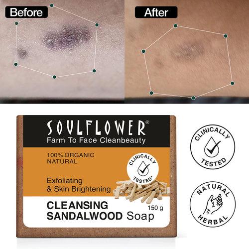 Sandalwood Soap Proven to Lighten & Brighten Skin BYOB