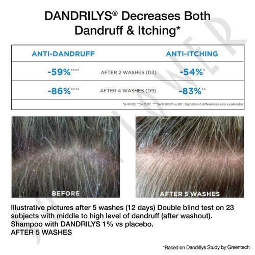 4-in-1 Daily Anti Shedding Dandruff Shampoo BYOB