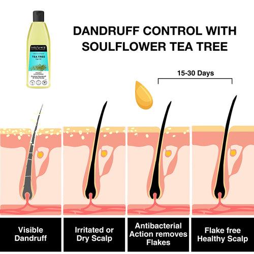 Complete Routine for Dandruff Free Hair Growth