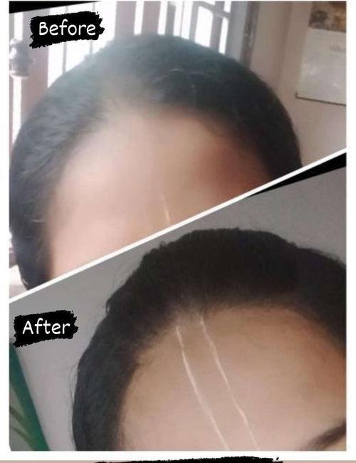 Baldness Serum