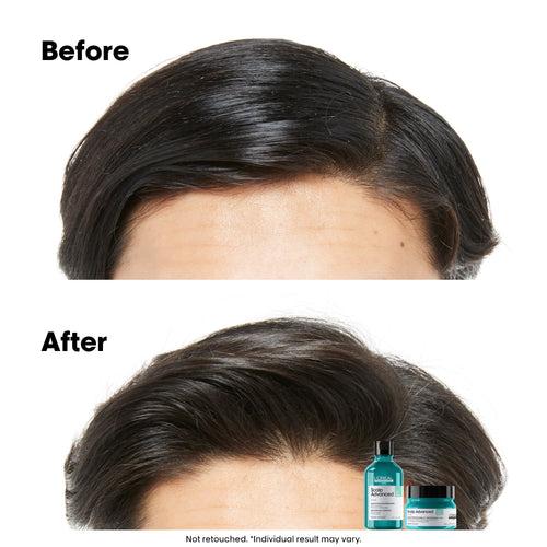 Scalp Advance - Anti-oiliness Dermo-Purifier Shampoo - (300 ml)