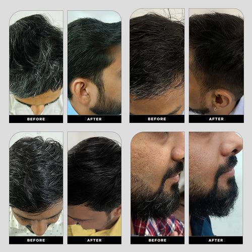 Anti-Graying Hair & Beard Cream