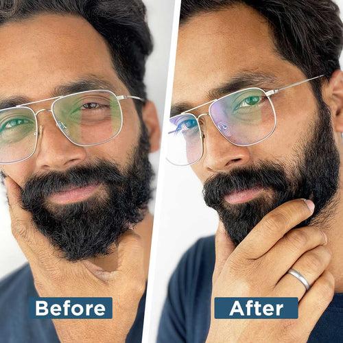 Advanced 5 in 1 Beard Grooming Kit
